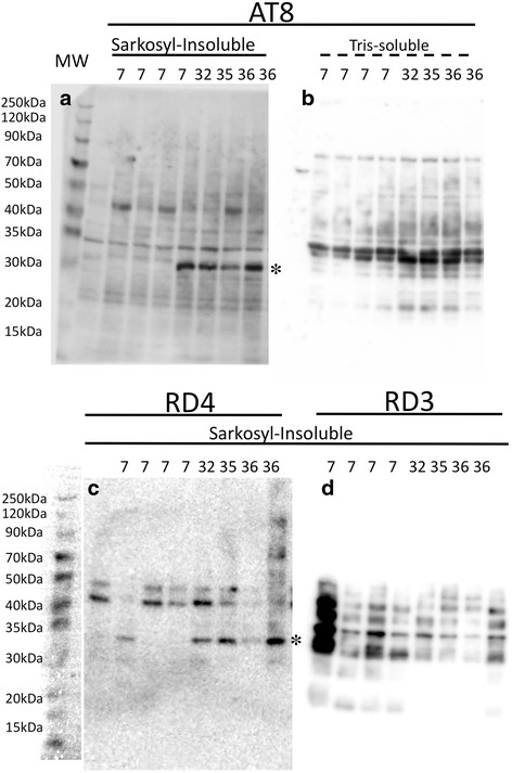Temporal lobe homogenates probed with AT8 and isoform-specific antibodies, RD3 and RD4. In sarkosyl-insoluble preparations, AT8-positive a and RD4-positive c bands were detectable between 30 and 35KDa in aged monkeys (asterisk 32, 35, 36 and 36 years-old) but not in young controls (7 years-old). This age associated increase is neither evident in Tris-soluble preparations probed by AT8 b, nor in sarkosyl-insoluble preparations probed with RD3 d. Higher molecular complex at 50–70 kDa, seen in human brain with tau deposits, were not detectable in either sarkosyl-insoluble preparations or tris-soluble preparations