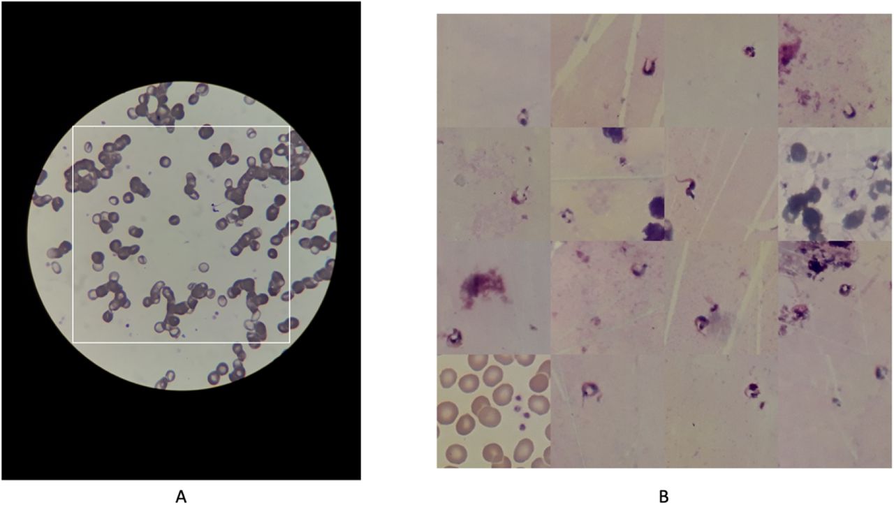 A) Field of view image, digitized with smartphone. B) Mosaic augmentation example.
