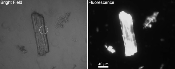 Whatman CF11 images. The characteristic curled structure of the fibres (circle).