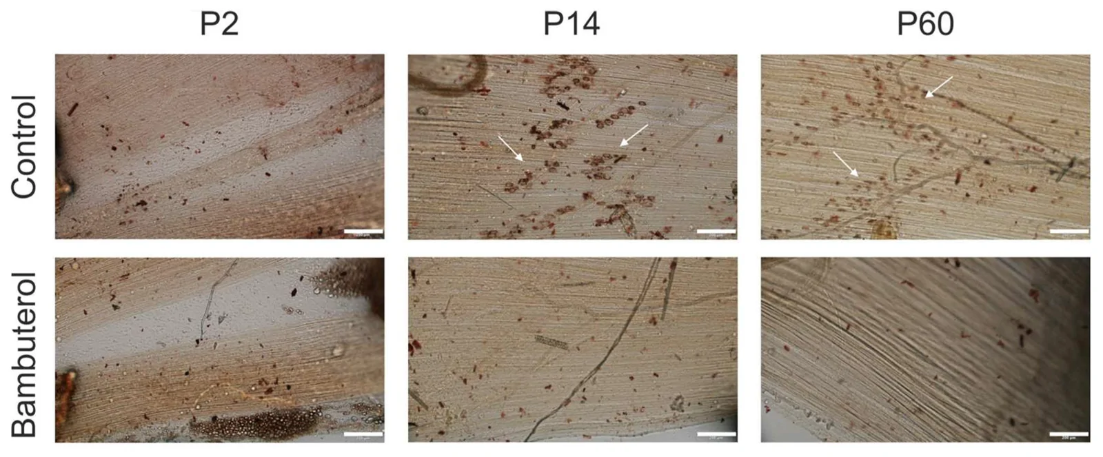 Histochemical detection of butyrylcholinesterase activity in the LAL muscles of newborn (P2), young (P14) and adult (P60) mice in Control and after the incubation with bambuterol (100 nM). The white arrows show an example of characteristic Hatchett’s brown precipitate (product of butyrylthiocholine hydrolysis). Scale bars, 200 µm. Representative images of muscles are obtained from a total of 5 muscles from 5 animals at each time point and in each group.