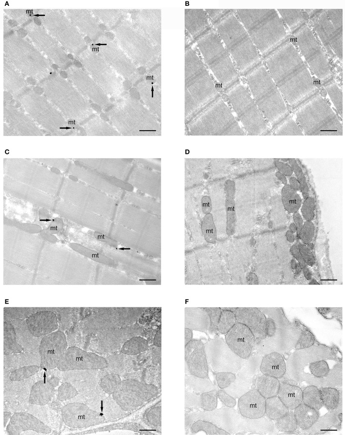 subcellular localization of CB1 receptors in mitochondria of striated muscles. Preembedding silver-intensified immunogold method for electron microscopy. CB1 immunoparticles (arrows) are localized in outer mitochondrial (mt) membranes of the gastrocnemius (A), rectus abdominis (C) and myocardial (E) muscles of CB1-WT mice. No labeling is observed in mitochondria (mt) of CB1-KO muscles (B,D,F). Scale bars: 0.5 μm. All electron micrographs were taken at the same magnification (x 22,000).