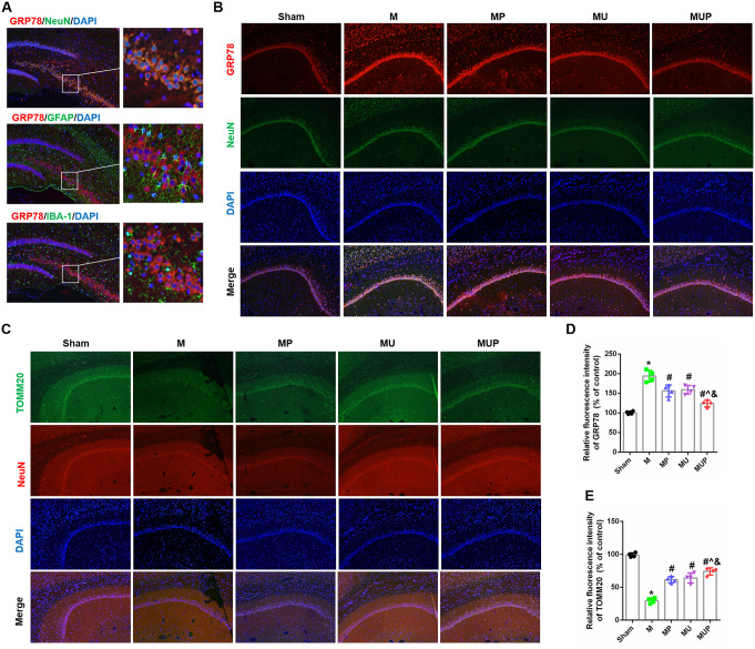 Effects of URB597 and 4-PBA on CCH-induced ER stress and mitochondrial function. A Representative double staining between GRP78 (red) and NeuN, Ibal-1, and GFAP (green) in the hippocampus. B, C Representative GRP78 and TOMM20 double staining with NeuN immunofluorescence, respectively. D, E Quantitative analysis of the relative fluorescence intensity. *p < 0.05 vs. Sham; #p < 0.05 νs. M, ^p < 0.05 νs. MP, &p < 0.05 νs. MU (n = 4)