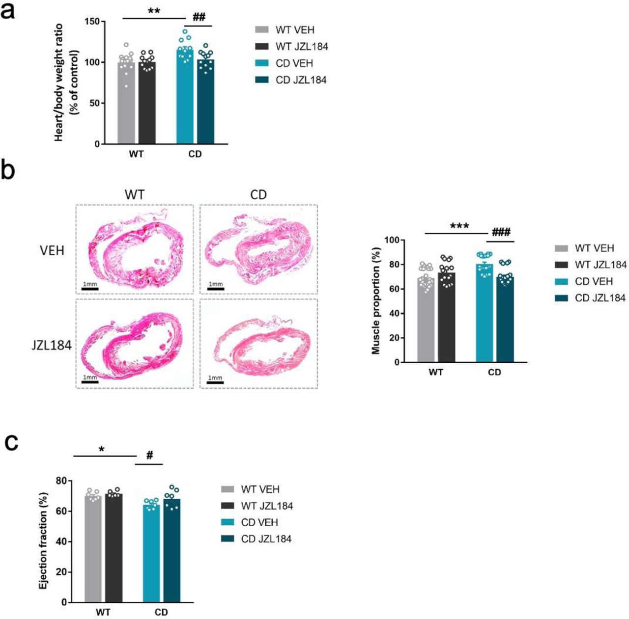 JZL184 administration regresses cardiac hypertrophy of CD mice. (a) Heart/body weight ratios obtained from WT and CD mice treated for 10 days with vehicle (VEH) or JZL184 (8 mg/kg) (WT VEH, n=14; WT JZL184, n=12; CD VEH, n=12; CD JZL184, n=13). (b) Representative haematoxylin-eosin stained transverse cardiac sections and quantification of muscle proportion from WT and CD mice treated for 10 days with vehicle (VEH) or JZL184 (8 mg/kg) (WT VEH, n=24; WT JZL184, n=16; CD VEH, n=20; CD JZL184, n=20 sections). (c) Ejection fraction (%) assessed by echocardiography from measurements performed on bidimensional images (WT VEH, n=8; WT JZL184, n=7; CD VEH, n=7; CD JZL184, n=7). Statistical significance was calculated by Newman- Keuls post hoc test following two-way ANOVA. * p<0.05; ** p<0.01; *** p<0.001 (genotype effect); # p<0.05; ## p<0.01; ### p<0.001 (treatment effect). Data are expressed as mean ± S.E.M.