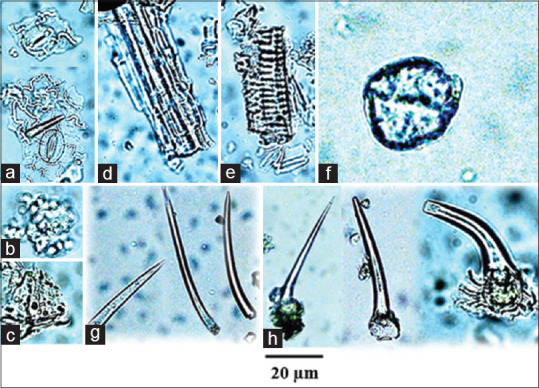 Powder microscopy of Cannabis sativa leaf; anomocytic stoma (a), palisade cell (b), parenchyma cell containing rosette aggregate crystal (c), fiber (d), spiral vessels (e), cystolith (f) unicellular trichomes (g), unicellular trichomes with cystolith (h)