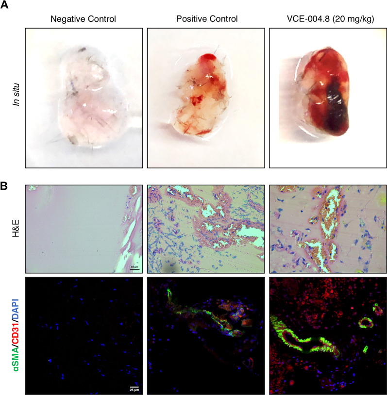 VCE-004.8 induces angiogenesis in vivo. A Gross morphology of Matrigel in situ. B Induction of vascularization shown by H&E and immunostaining of CD31+/αSMA+ cells in the plugged Matrigel. Negative control corresponds to Matrigel that only contains heparin; positive control corresponds to Matrigel that contains heparin plus VEGFA and FGF2. Scale bars equivalent to 50 µm (H&E) and 25 μm (CD31+/αSMA+)