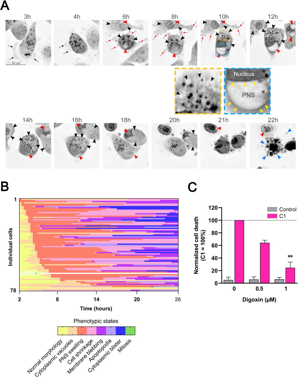 Synergistic C1 treatment triggers an autosis-to-apoptosis switch.MDA-MB-231 cells were monitored via label-free HTM for 24 h, beginning 2 h post-C1 treatment to resolve the subcellular kinetics of cell death. (A) Representative 2D maximum intensity projections of the refractive index. Insets demonstrate higher magnifications of intracytoplasmic vacuoles (orange square) and focal swelling of the perinuclear space (PNS) leading to nuclear compression (blue square), hallmarks of autosis. Red, yellow, black, and blue arrowheads indicate PNS swelling, nuclear membranes, cytoplasmic vacuoles, and apoptotic fragmentation, respectively. Black and red arrows denote lamellipodia and bleb-rich protrusions. Scale bars: 20 µm. (B) Single-cell phenotypic trajectory analysis (fate mapping) of 78 individual C1-treated cells over 24 h. Horizontal lines represent the temporal evolution of individual cells; colours denote discrete phenotypic states. Trajectories are ordered by the onset of PNS swelling to demonstrate the kinetic conservation of the autotic phase across the population. (C) Pharmacological rescue of C1-induced autosis by digoxin. MDA-MB-231 cells were pre-treated for 2 h with digoxin (0.5 and 1 µM) prior to C1 exposure. Data represent relative cell death normalized to the C1-only group (100% reference baseline, dashed line) at t = 6 h. Results are presented as mean ± SD (n=3). Statistical significance was assessed by a one-sample t-test (relative to the 100% baseline); ** p < 0.01.