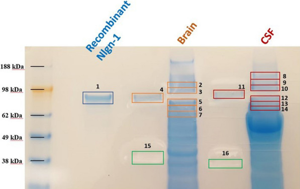 SDS-page gel (Coomassie-stained) for protein visualization and band excision for protein identification using mass spectrometry. Highlighted in the figure are the excised gel segments for the recombinant protein (1), TBS brain extract (2 to 7), and CSF sample (8 to 14). To avoid cross-contamination and protein diffusion between lanes, samples were loaded with two empty lanes in between them. Control gel segments were also cut (4, 11, 15, 16, negative controls), to further check for protein contamination between lanes. The excised gel segments were digested and protein extracted for MS analysis