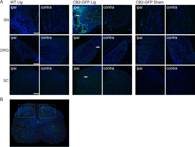 Expression of the CB2 receptor in nervous tissue. (A) Representative stainings of GFP (green) in the sciatic nerve (SN), dorsal root ganglia (DRG) and dorsal horn of the lumbar spinal cord (SC). (B) Lumbar section of the spinal cord, illustrating both dorsal horns, in a WT animal 14 days after nerve ligation. Iba1 staining (green) is increased on the ipsilateral side (right). White frames indicate imaged areas for the SC sections (A). GFP expression under a CB2 promoter is shown in ligated and sham treated CB2-GFP mice 14 days post SNL. Ligated WT animals served as control. Arrows indicate GFP positive cells. Cell nuclei were stained with DAPI (blue) (scale = 100 µm).