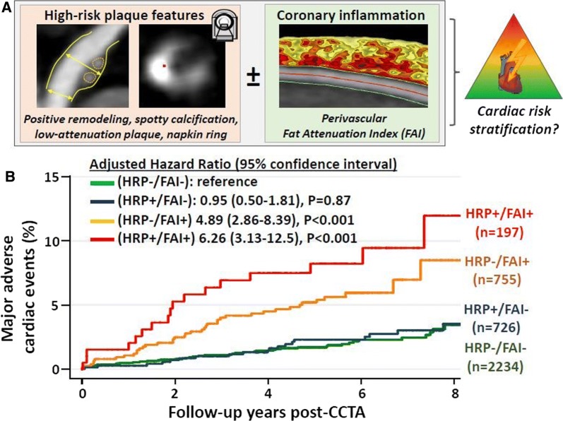 Assessment of high-risk plaque features and coronary inflammation on computed tomography coronary angiography and prediction of major adverse cardiac events. (A) Shows the high-risk plaque features (HRP) combined with the assessment of perivascular fat attenuation index (FAI). (B) shows the Kaplan Meier curves for occurrence of major adverse cardiovascular events; patients with HRP features and coronary inflammation based on FAI had significantly worse prognosis as compared to the other groups of patients. Reproduced with permission from Oikonomou et al21