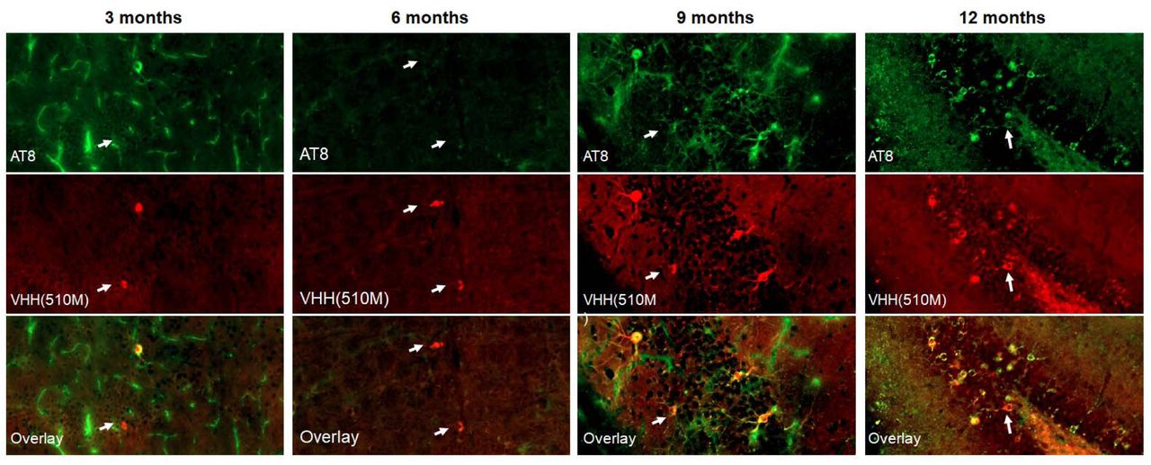 Age-dependent immunostaining of P301S mouse brains with VHH(510M).Shown are representative images from 3-, 6-, 9-, and 12-month-old P301S tauopathy mice stained with the phospho-tau antibody AT8 (green) and anti-tau VHH510M (red). Anti-tau VHH510M labels pathological inclusions that overlap with AT8-positive aggregates but also highlights additional inclusions not recognized by AT8 (white arrows). These observations suggest that VHH(510M) detects both phospho-tau and non-phosphorylated forms of aggregated tau. See Figure S9 for additional images and details.