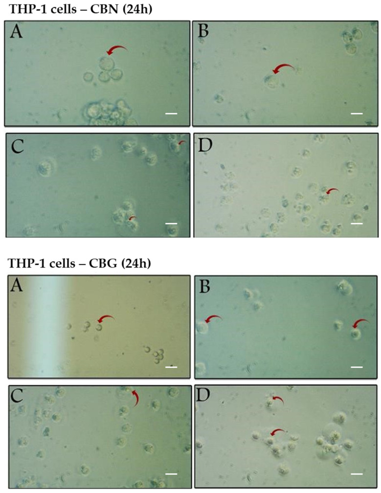 Effect of CBG or CBN treatment on THP-1 cell morphological characteristics. THP-1 cells were treated with CBN (upper panel) or CBG (lower panel) for 24 h at concentrations of 0 µM (A), 1 µM (B), 50 µM (C), and 100 µM (D). The red arrows mark changes in morphological characteristics in THP-1 cells in comparison with the control 0 µM (A). Representative fields were imaged at 200× magnification. Scale bar = 25 µm.