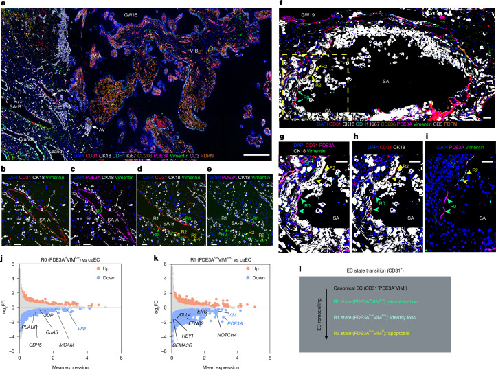 CODEX validation of stepwise arterial endothelial state transitions during EVT remodelling of spiral arteries.a, An overview of multiplexed CODEX imaging of a representative tissue section from a human basal plate sample (GW15). The selected markers (and their specificity): DAPI (nuclei), CD31 (endothelial cells), CK18 (cytotrophoblasts, particularly EVTs), CDH1 (endometrial epithelium and cytotrophoblasts), Ki67 (proliferation), CD206 (macrophages and Hofbauer cells), PDE3A (arterial endothelial and perivascular smooth muscle cells), vimentin (decidua stromal cells and a subset of vascular and lymphatic endothelial cells), CD3 (T cells) and PDPN (lymphatic endothelium and fetal fibroblasts). Marker specificities are shown in Extended Data Fig. 6g. SA, spiral artery; AV, anchoring villi. Scale bar, 400 μm. b–e, Higher-magnification CODEX imaging of spiral arteries SA-A highlighting CD31 (b) and PDE3A (c), and SA-B highlighting CD31 (d) and PDE3A (e) recapitulated the transient arterial endothelial states at the protein level: R0 (PDE3A+VIM−), R1 (PDE3A−VIM−) and R2 (PDE3A−VIM+). Biological replicates of the CODEX analysis are included in the Extended Data Fig. 7a. Scale bars, 50 μm. f, Overview of CODEX imaging near an extensively remodelled spiral artery from a GW19 basal plate sample. Scale bar, 100 μm. g–i, Magnification of the boxed region from f, showing the details of the distinct endothelial states across selected channels: CD31, PDE3A, CK18 and vimentin (g), and CD31 and CK18 (h). i, R0 (green arrows) and R2 cells (yellow arrows) are spatially segregated. Scale bars, 50 μm. j,k, Differential gene expression analysis comparing spatial transcriptomic profiles: R0 versus caECs (j) and R1 versus caECs (k). Genes involved in cell–cell junctions (for example, PLAUR, CDH5 and JUP) were down-regulated in R0 versus caECs (j), whereas genes that define arterial identity (for example, DLL4, EFNB2, HEY1 and ENG) were down-regulated in R1 versus caECs (k). l, Proposed stepwise model of endothelial (CD31+) state transitions during spiral artery remodelling. CaECs (PDE3AhiVIMhi) → R0 (PDE3AhiVIMlow) → R1 (PDE3AlowVIMlow) → R2 (PDE3AlowVIMhi).