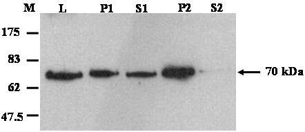 Western blotting analysis of distribution of HIS-FAAH in membrane fractions of Dictyostelium. Total cellular protein (L) from AX3FAAH cells were fractionated into 13,000xg membrane and cytosol fractions (P1 and S1 respectively) and 100,000xg membrane and cytosolic fractions (P2 and S2 respectively). Described membrane and cytosolic fractions were separated on 10% SDS-PAGE and subjected to Western blotting using anti-HIS antibody. M represents molecular mass standard in kDa.