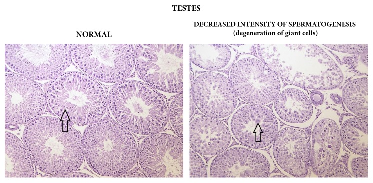 Testes: comparison of normal (control) tissue to tissue in a male from the 3000/4000 mg/kg bw/day group showing decreased intensity of spermatogenesis, 14-day study.