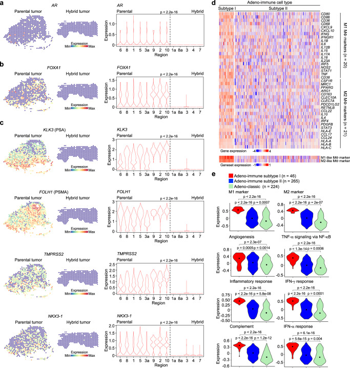 THCs resemble a subtype of metastatic castration-resistant prostate cancer (mCRPC).a–c Spatial transcriptomics analysis of the androgen receptor (AR) signaling in the parental and hybrid tumors. Left: representative spatial heatmap showing the expression of human AR (a), FOXA1 (b), or the AR-target genes KLK3, FOLH1, TMPRSS2, and NKX3-1 (c) in parental tumor regions 1, 5, and 6, and hybrid tumor regions 4 and 7. Right: violin plots showing the mean enrichment scores of the aforementioned genes in each region. Hybrid tumor displayed very low expression of AR-target genes. d, e Two subtypes were identified from the Adeno-immune group of mCRPC from four published RNA-seq datasets based on M1- and M2-like macrophage gene expression43–47. Heatmap depicting elevated expression of M1- and M2-like macrophage genes in Adeno-immune subtype I (d). Violin plots showing the expression of eight immune-related genesets in Adeno-classic, Adeno-immune subtype I, and Adeno-immune subtype II cancer cells (e). See also Supplementary Fig. 7c, d and Supplementary Table 1. P-values were determined using a two-sided Wilcoxon rank-sum test (a–c) and a two-sided unpaired t-test (e).