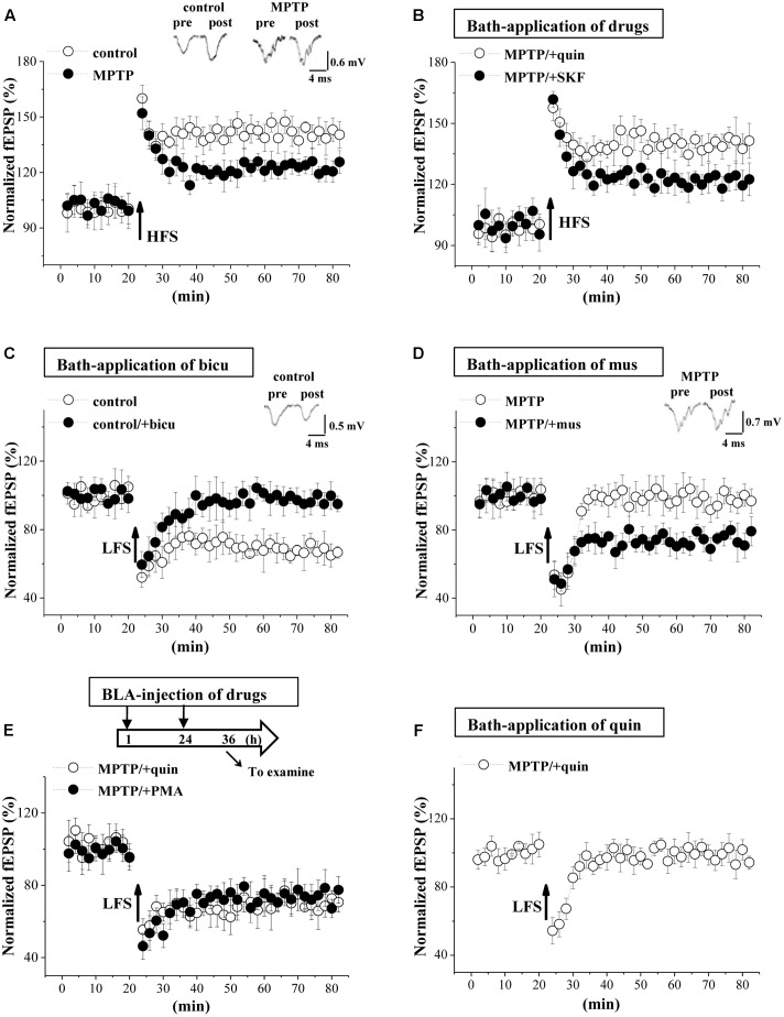 MPTP-reduced GABAAR activity impairs LTD induction. (A) LTP induction by applying high-frequency stimulation (HFS) in control mice and MPTP-mice. Each point represents the mean value of fEPSP slopes expressed as a percentage of baseline. A solid arrow indicates when HFS was given. (B) LTP induction in slices of MPTP-mice treated with bath-application of SKF38393 (SKF) or quinpirole (quin). (C) LTD induction by low-frequency stimulation (LFS) in slices of control mice treated with bicuculline (bicu). (D) LTD induction in slices of MPTP-mice treated with muscimol (mus). (E) LTD induction in MPTP-mice treated with BLA-injection (BLA) of SKF38393 (SKF) or quinpirole (quin). Time chart of the experimental procedure (upper panel). ↓: time of drug administration; ↘: time of electrophysiological experiments. (F) LTD induction in slices of MPTP-mice treated with bath-application of quinpirole (quin).
