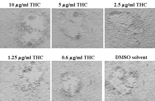THC has no significant effect on plaque formation of HSV-1 in NIH3T12 cells. NIH3T12 monolayer cultures propagated in 6-well plates were infected with about 100 infectious units of HSV-1 per plate and cultured in the presence of various concentrations of THC or equivalent DMSO solvent. Photographs were taken four days after infection.