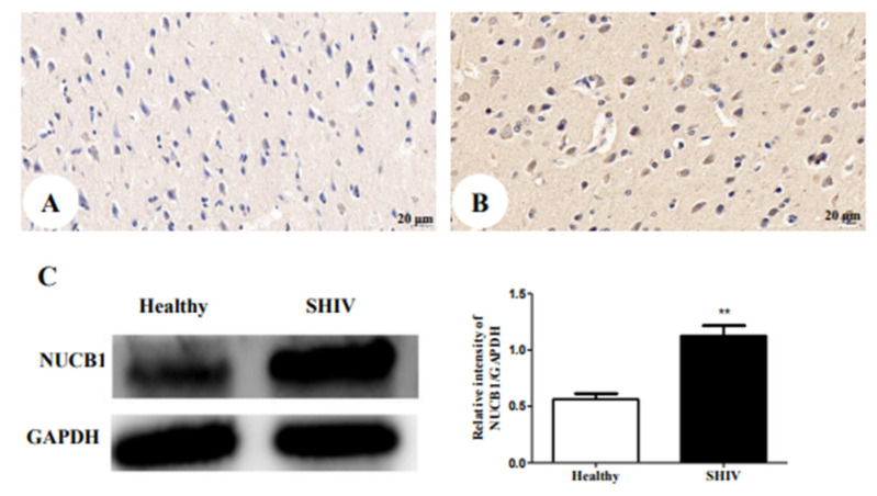 NUCB1 protein expression in cerebral cortex: (A) the healthy control (400×); (B) SHIVKU-1-infected monkey (400×) (C) comparison of NUCB1 expression of cerebral cortex in healthy control and SHIVKU-1-infected monkey using Western blotting. In the column, from the t test, statistically significant differences of the two groups can be determined (p = 0.0056). ** p < 0.01.