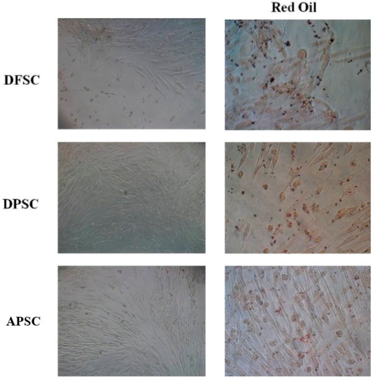 Images in light microscopy of induced DFSCs, DPSCs, and APSCs for adipogenic differentiation, cultivated for 14 days in adipogenic medium. Right panel: red oil stain.