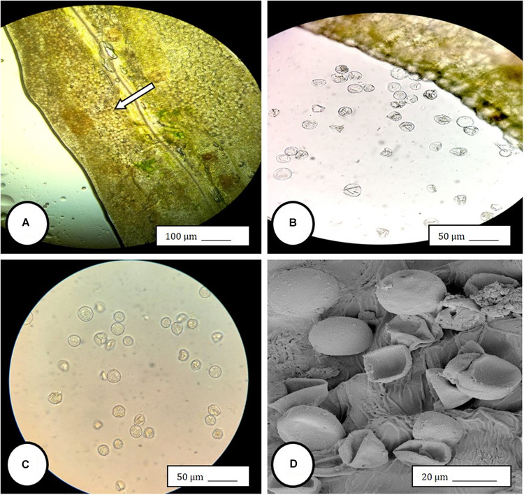 Light and scanning electron microscopic observations of anthers and pollen grains in hermaphroditic flowers of Cannabis sativa. (A) The anther wall and groove are visible and pollen grains can be seen packed within the anther pollen sacs (arrow). (B) Release of pollen grains into water used to mount the sample. (C,D) Intact and collapsed pollen grains as viewed in the light microscope (C) and the scanning electron microscope (D).
