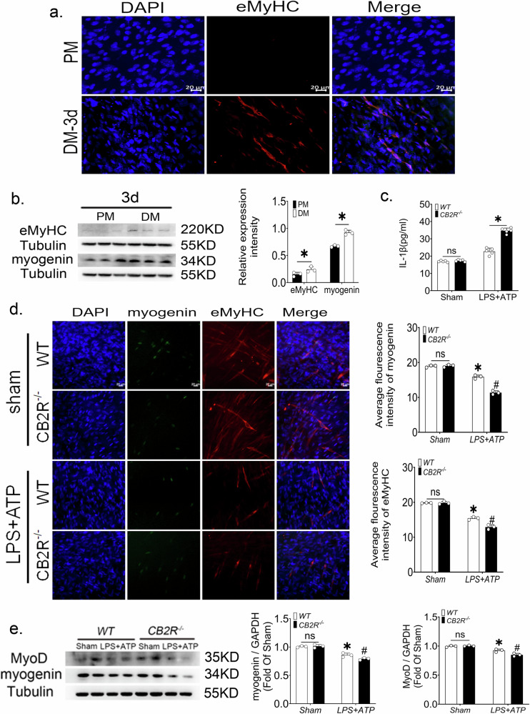 CB2R knockout macrophages impede the differentiation of C2C12 cells.a Representative pictures of immunofluorescence of eMyHC, scale bar = 20 μm. b eMyHC and Myogenin protein expression levels of C2C12 cells, n = 3, *p < 0.05 PM-3d vs. DM-3d group. c The release of IL-1β from macrophages after LPS + ATP treatment, n = 5, *p < 0.05 Cb2r−/− vs. WT group. d Expression of Myogenin and eMyHC in C2C12 cells after treatment with peritoneal macrophage-conditioned medium, scale bar = 20 μm, n = 3, *p < 0.05 sham vs. LPS + ATP group, #p < 0.05 WT vs. Cb2r−/− group. e MyoD and Myogenin protein expression levels in C2C12 cells in different treatment groups, n = 3, *p < 0.05 sham vs. LPS + ATP group, #p < 0.05 WT vs. Cb2r−/− group. Data are represented as mean ± SD. ns no significance.