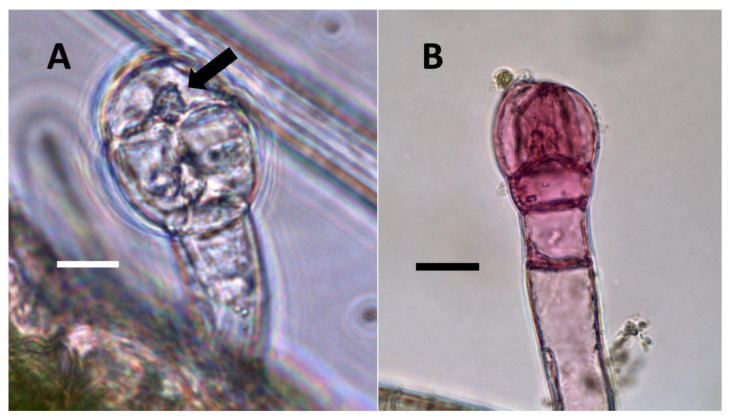 Rhus glabra seedling leaf trichomes stained for nitric oxide using iron sulfate. (A) Non-sterilized seedling trichome stained with iron sulfate to show nitric oxide (brown color) around bacteria (arrow) internally (Bar = 10 µm). (B) Trichome on seedling developed from surface-sterilized seeds stained with iron sulfate showing smaller size and absence of nitric oxide staining internally. The pink color may be due to anthocyanins or other pigments (Bar = 10 µm).