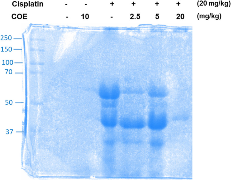 Cannabis oil extract reduces albumin in urine of cisplatin treated mice. SDS-PAGE study for albumin detection in urine samples of mice.The samples were run on a Bio-Rad protein electrophoresis equipment and staining was performed with Coomassie blue. The bands at 65 KDa represent albumin