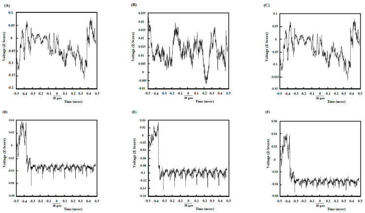 Z-normalized time-domain signals of ACC. The group’s time-domain averages signal acquired from ACC in control animals (A), agonist-treated animals (B), and antagonist-treated animals (C) while reaching a remuneration. Z-normalized time-domain of group averages signals acquired from the NAc. The group’s time-domain averages signal acquired from NAc in the control group (A), the agonist-treated animals (B), and the antagonist-treated animals (C) while reaching a remuneration. The group’s time-domain averages signal acquired from NAc in the control group (D), the agonist-treated group (E), and the antagonist-treated group (F).
