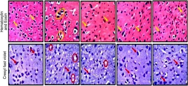Representative photomicrographs of the prefrontal cortex of animals fed cannabis diet and untreated controls. A high power magnification showing the general histomorphology (H&E) and Nissl body characteristics (CFV) of animals fed 40%, 20%, 10%, and 1% for 14 days. The pyknotic cells are identified by the yellow arrows, while the chromatolytic neurons are captured in red circles. The chromatolytic neurons were also captured in yellow circles but under H&E staining, while the red arrows point to the pyknotic cell under the CFV staining. CFV, cresyl fast violet; H&E, hematoxylin and eosin.