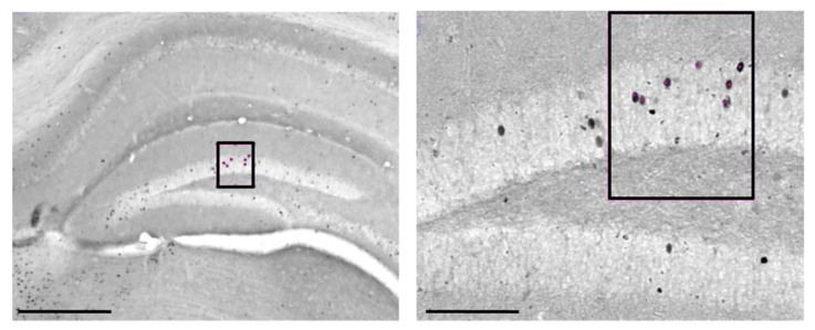 Representative photomicrographs of c-Fos+ cells (highlighted in the black boxes) in hippocampal CA1, CA3 and dentate gyrus (DG) of an animal treated with vehicle at lower (4×) (on the left, Scale bar: 1000 μm) and higher (20×) (on the right, Scale Bar: 200 μm) magnification.