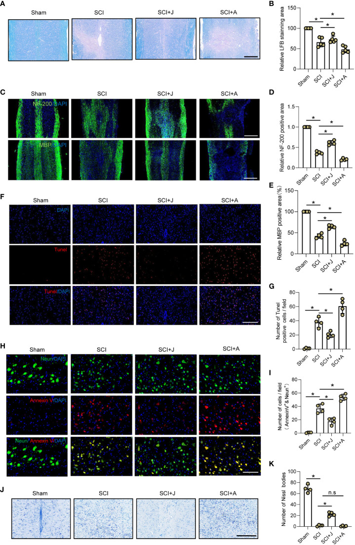CB2R ameliorated secondary neuronal apoptosis and demyelination post-SCI. (A) LFB staining of spinal cords on day 7 post-SCI. Scale bar = 200 μm. (B) Quantitative analysis of LFB-labeled area. (C) IF staining of NF200 or myelin basic protein (green) on day 7 post-SCI. Scale bar = 500 μm. (D) Quantitative analysis of NF200. (E) Quantitative analysis of myelin basic protein. (F) TUNEL staining of spinal cords on day 7 post-SCI. Scale bar = 100 μm. (G) Quantitative analysis of TUNEL-positive cells. (H) IF staining of Neun (green) and Annexin V (red) on day 7 post-SCI. Scale bar = 100 μm. (I) Quantitative analysis of Annexin V-positive neurons. (J) Nissl staining of spinal cords on day 7 post-SCI. Scale bar = 200 μm. (K) Quantitative analysis of the number of neurons. * p < 0.05. n.s means no significance.