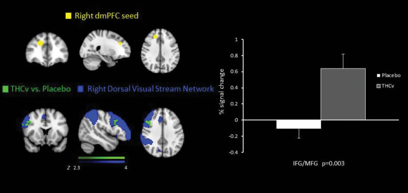 Coronal, sagittal, and axial slices showing the right dorsal medial prefrontal cortex seed region and functional connectivity maps for the difference between placebo and tetrahydrocannabinol (THCv) groups, overlaid on the right dorsal visual stream network. The right graph displays the % blood-oxygenation-level-dependent signal change extracted from the region of significant treatment effect. inferior frontal gyrus/medial frontal gyrus: 52 28 22 and p = 0.003 for the placebo group and THCv group.