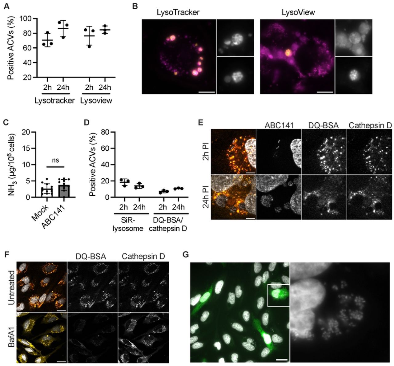 ABC141 multiplies in an acidic late endosomal vacuole, segregated from degradative lysosomes and competent for infection of neighbouring endothelial cells.(A) Quantification of the percentage of ACVs positive for either Lysotracker or Lysoview at 2 and 24h post-infection. Data are means ± SD, N = 3. (B) Epifluorescent images of Lysoview-positiveACVs (magenta) with GFP-ABC141 (yellow) at 24h. Scale bars 10μm (C) Quantification of intracellular levels of ammonia normalized to the number of cells in mock- or ABC141-infected cells after 24h. Data are means ± SD, N = 11. (D) Quantification of the percentage of ACVs positive for either SiR-Lysosome or simultaneously DQ-BSA and cathepsin D labelling at 2 and 24h post-infection. Data are means ± SD, N = 3. (E) Confocal images of DQ-BSA (red) and cathepsin D (yellow)-negative ABC141 (white) ACVs at 2 and 24 h. Dapi allows visualization of nuclei and bacteria. Scale bar 5μm. (F) Confocal images of control non-infected cells treated or not with Bafilomycin A1. DQ-BSA (red), cathepsin D (yellow) and Dapi for nuclei. Scale bars 20 µm. (G) Re-infection assay following addition of Cell Tracker-labelled cells (green) at 24h post-infection and incubation for a further 48h. Hoechst was used for imaging bacteria and nuclei (grey). Image on the right corresponds to zoom of highlighted cell. Scale bars 20 μm