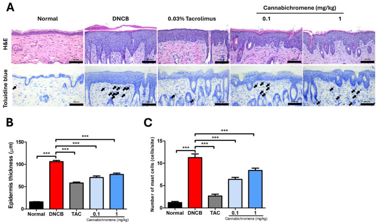 Result of staining after treating cannabichromene on atopic dermatitis mouse model dorsal skin. (A) Representative H&E stain and Toluidine blue stain images from each group (200× magnification, arrows indicate mast cells), (B) results of measuring epidermis thickness after H&E stain (total n = 5/group), (C) results of counting mast cell invasion (total n = 5/group), data shown in the figure are provided as mean ± SEM (*** p < 0.001 vs. normal group or DNCB group). DNCB, 1-chloro-2,4-Dinitrochlorobenzene; TAC, 0.03% tacrolimus; H&E, Hematoxylin and Eosin.