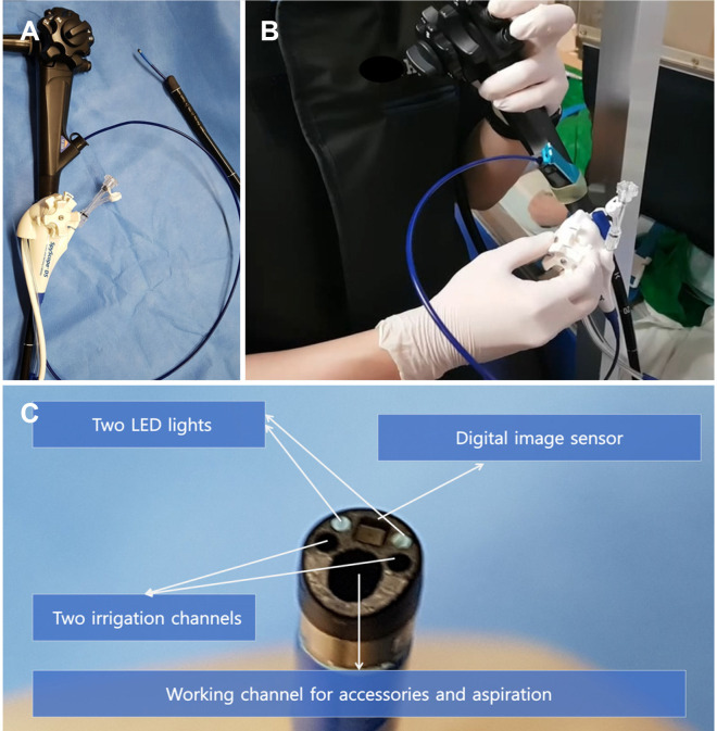 Single-operator cholangioscopy using the SpyGlass DS system. (A) The SpySope is inserted into the duodenoscope through the working channel. (B) A single endoscopist controls both the duodenoscope and SpyScope (the reason this is called “single-operator” cholangioscopy). (C) The SpyScope, which is the single-use cholangioscope of the SpyGlass DS System.