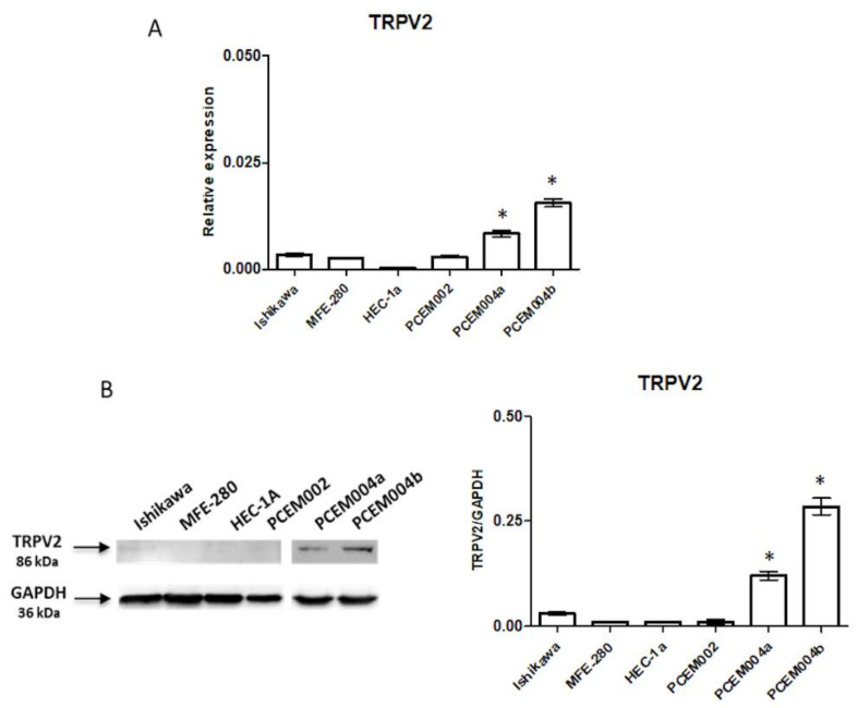 TRPV2 expression on EC cell lines. (A) TRPV2 mRNA expression was evaluated by quantitative real time-PCR (qRT-PCR) in six EC cell lines. TRPV2 mRNA levels were normalized for glyceraldehyde-3-phosphate dehydrogenase (GAPDH) expression. Data are expressed as fold mean ± standard deviation (SD) of three separate experiments. * p < 0.05 vs. type I EC cell lines (B) TRPV2 protein expression was evaluated by Western blot in six EC cell lines. TRPV2 densitometry values were normalized to GAPDH used as loading control. Densitometric values shown are the mean ± SD of three separate experiments. * p < 0.05 vs. type I EC cell lines.