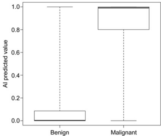 Box-and-whisker plot of the AI predictive value with benign and malignant distal bile duct obstruction. AI: artificial intelligence.