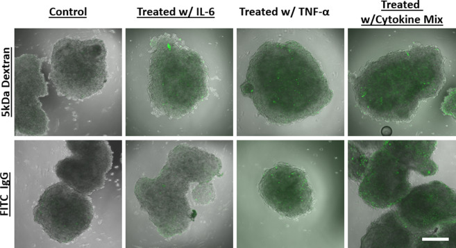 Exogenous cytokines increased BBB permeability. Organoids were incubated with IL-6 only, TNF-α only, or a combination of cytokines (IL-2, IL-6, VEGF, and TNF-α) for 12 hours. BBB permeability was assessed using a 5 kDa FITC dextran and FITC labeled IgG. The concentration for each of cytokines used was 5 ng/ml. The dextran molecule traversed across the BBB in organoids treated with cytokines. However, IL-6 alone did not induce BBB permeability. Scale bars 300 μm, the experiment was repeated twice. Images shown are middle slices of the z-stack confocal image.