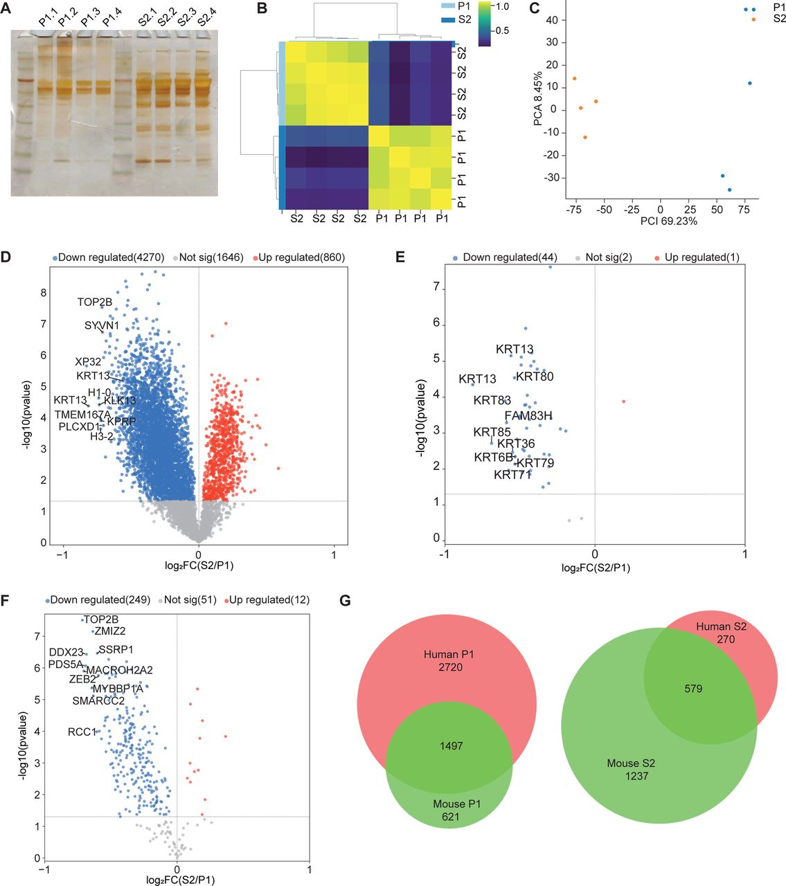 Isolated peripheral terminals from humans lack histone and keratin.(A) Silver staining of protein isolated from P1 fraction (lanes 1-4) and S2 fraction (lanes 5-8). (B and C) Principal component analysis (B) and heat map (C) with the Pearson correlation coefficient between samples showing high reproducibility of S2 and P1 fractions from n=4 biological replicates. (D) Volcano plot showing relative protein enrichment of S2 compared to P1 fractions. The red and blue dots depict significantly (p<0.05) enriched proteins in S2 and P1, respectively. (E and F) Volcano plots of pre-defined keratin (GO term ‘keratin filaments’) (E) and chromatin-associated proteins (GO term ‘chromatin’) (F). (G) Venn diagram representing the overlap in differentially enriched proteins in the P1 and S2 fraction of mouse and human samples.