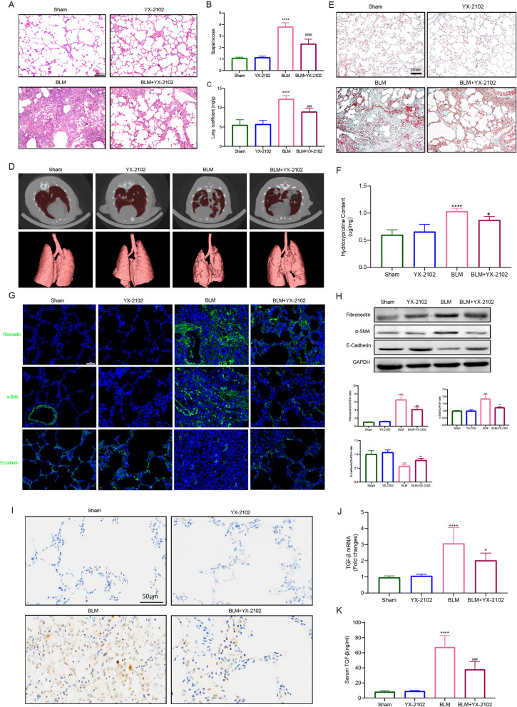 YX-2102 can protect against BLM-induced PF in vivo. Rats were intratracheally treated with 5 mg/kg BLM once at day 0, followed by YX-2102 or vehicle treatment via intraperitoneal injection at 25 mg/kg daily. A H&E staining of representative lung sections of the sham, YX-2102, BLM and BLM + YX-2102 groups at day 21. B Quantification of pulmonary fibrosis using the Szapiel score. C Lung coefficient index. D Micro-CT scan images of rats (in vivo) at 21 days after exposure. E Representative images of Masson’s trichrome staining of rat lungs at day 21. F The Hyp level of the pulmonary tissues. G Representative immunofluorescence staining images showing the expression of fibronectin, α-SMA and E-cadherin in rat lungs. H Western blotting showing the expression of fibronectin, α-SMA and E-cadherin in rat lungs. Histograms of protein ratios were normalized to a marker protein—the cellular skeletal glyceraldehyde-3-phosphate dehydrogenase (GAPDH, n = 3). I–K TGF-β1, the major pro-fibrotic factor, as identified by immunohistochemical assay (I) and quantitative RT-PCR (J) in lung tissues and ELISA (K) in rat serum at day 21. Scale bar is indicated in the figure. Data were expressed as mean ± SEM, n = 5, ****P < 0.0001 versus Sham groups, #P < 0.05, ###P < 0.001, ####<0.0001 versus BLM group
