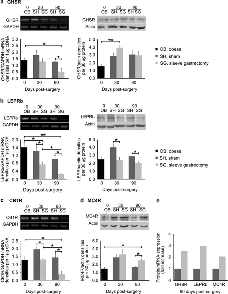 SG alters the mRNA and protein levels of receptors in the hypothalamus. (a) Detection of Ghsr expression levels by semiquantitative RT-PCR revealed a significant decrease in the mRNA levels of SG animals at 90 days post surgery, as compared with sham or obese animals, whereas GHSR protein levels, detected by WB, increased significantly post SG relative to obese animals. Following SG, (b) the expression of Leprb at both the mRNA and protein levels was constantly significantly lower from that of their sham counterparts; this effect is also observed for (c) CB1 receptor message levels. (d) MC4R protein levels in the hypothalamus showed a significant upregulation by 90 days after SG, as compared with sham surgery. (e) Calculation of the protein over mRNA ratio provided evidence for the expression levels of each receptor relative to the mRNA. The protein/mRNA ratio of the sham group for each receptor was considered as 100%. By 90 days post SG GHSR exhibited a 2.5-fold, LEPRb a threefold and MC4R a twofold increase of their expression levels. Representative images of RT-PCR and WB are illustrated on top of the respective graphs. The expression levels of the housekeeping markers GAPDH and actin were used to normalize the genes of interest expression levels for RT-PCR and WB, respectively. n=4–6 animals per group; *P< 0.05 and **P< 0.01.