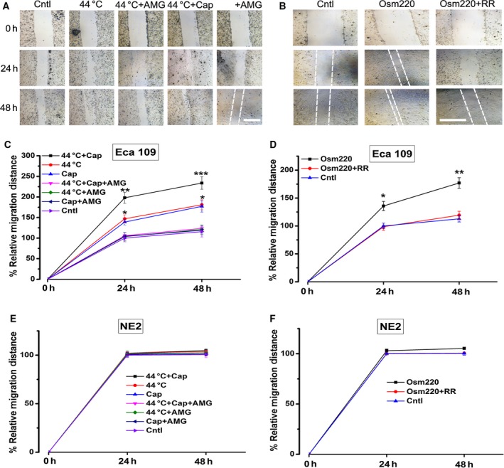 Effects of overactivation of TRPV1 and TRPV4 on the migration of Eca109 and NE2 cells. Cell migration was assessed via a wound healing assay. (A) Representative images of Eca109 cell migration after exposure to capsaicin (15 μm) and/or heat stimulation (44 °C water bath). AMG9810 (10 nm) was used as a TRPV1 antagonist. The white broken lines assisted to define the edging of the wounds. (B) Sample pictures of Eca109 cell migration after recurrently brief exposure to hypotonic medium (220 m Osm). Ruthenium red (RR, 15 μm) was used as a TRPV inhibitor. (C) Eca109 cell migration was promoted substantially by the application of 15 μm capsaicin and/or recurrently brief exposure to heat (44 °C); cell migration was enhanced much greater by the simultaneous treatment with capsaicin and heat stimuli; these effects could be abrogated by AMG9810 (10 nm). (D) Eca109 cell migration was accelerated considerably by recurrently brief exposure to hypotonic medium (220 m Osm); this effect was compromised by ruthenium red (15 μm). (E) NE2 cell migration was not affected by the application of 15 μm capsaicin and/or heat stimulation (44 °C water bath) even up to 17 days. (F) NE2 cell migration was unaffected by recurrently brief exposure to hypotonic medium (220 m Osm) even up to 17 days. Cap, capsaicin; AMG, AMG9810; Osm220, osmotic pressure 220 mm Hg; RR, ruthenium red; Cntl, control. *P < 0.05, **P < 0.01, ***P < 0.001. Bar = 1.0 mm
