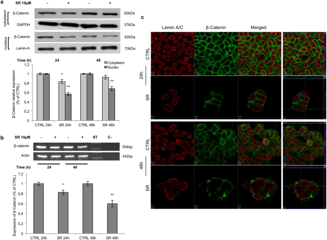 Subcellular localization of β-Catenin. (a) Western blot analysis of β-Catenin in nuclear and cytoplasmic fractionated extracts from HCT116 cells treated with SR141716 (SR). The histograms depict the densitometric analysis of cytoplasmic and nuclear amounts of β-Catenin normalized versus GAPDH and Lamin A/C respectively and expressed as percentage of control. (b) RT-PCR analysis of β-Catenin in HCT116 cells untreated (−) or treated (+) with SR141716 (SR). In the lower panel the densitometric analysis of β-Catenin mRNA normalized for actin is shown. Data are shown as mean ± SD (unpaired two tailed Student’s t-test *p < 0.05, **p < 0.01). (c) HCT116 cells treated with SR141716 (10 μM) or vehicle (CTRL) were stained with anti β-Catenin antibody (green fluorescence) and anti Lamin A/C antibody (red fluorescence). In right panels orthogonal view of 0.5 μm thickness in the z plane was reported. Cropped images from full-length gels are displayed in a and b.