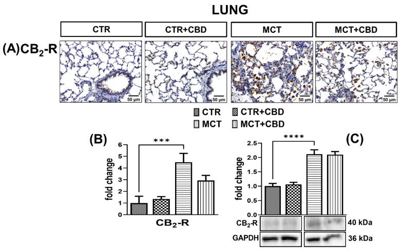The influence of monocrotaline (MCT)-induced pulmonary hypertension and cannabidiol (CBD) or its vehicle on cannabinoid receptor type 2 (CB2-R) (A); representative micrographs of immunohistochemical staining (magnification 200×) (B) and their quantification; and (C) the density of CB2-R determined by Western blot in rats’ lungs. Bar graphs B and C illustrate the fold changes (for the relative fold change in expression in comparison to the respective CTR, whose expression level was set to 1) in the percentage area stained for CB2-R and in the density of CB2-Rs, respectively. The dark brown precipitate represents the intensity of CB2-R. CBD (10 mg/kg), or its vehicle was injected i.p. every 24 h for 21 days. Data are presented as mean ± SEM, (n = 6–7 per group); *** p < 0.001 and **** p < 0.0001, compared to the respective group.