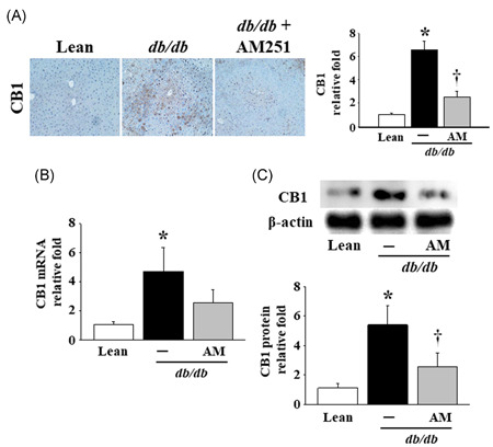 Effects of AM251 on the hepatic levels of CB1 in db/db mice. A, Representative result of the CB1 IHC stain in liver tissues of the Lean control mice and db/db mice treated with or without 5 mg/kg AM251. Dark brown color indicates the site of CB1, and the results are shown at ×200 magnification. The score of images was quantified using Panthera L Smart Light Microscope system. B, The mRNA and (C) protein levels in the liver tissues of mice were detected using quantitative real‐time polymerase chain reaction and Western blot analysis, respectively. *P < .05 vs Lean control mice (n = 8); † P < .05 vs db/db mice (n = 8). CB1, cannabinoid receptor type 1; IHC, immunohistochemistry; mRNA, messenger RNA