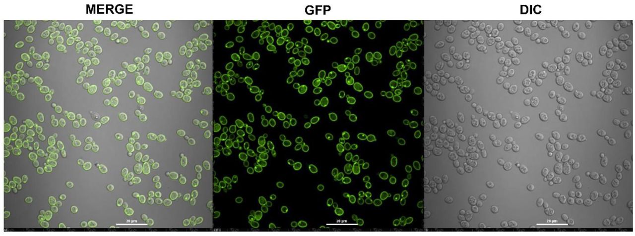 Confocal imaging of AD-CauMdr1-GFP strain.S. cerevisiae AD1-8u- cells expressing GFP-tagged CauMdr1 protein at the plasma membrane.