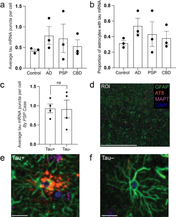 Astrocytes do not upregulate tau mRNA in astrocytic tauopathies. (A) Mean number of mRNA puncta per astrocyte in control, AD, PSP, and CBD. (B) Proportion of tau mRNA positive astrocytes in control, AD, PSP, and CBD. (C) Mean number of puncta comparing tau-positive and negative astrocytes within cases of PSP. (D) Representative low power ROI with insets of tau-positive and negative astrocytes shown in (E) and (F), respectively. Scale bars = 1000 μm in (D) and 20 μm in (E) and (F); n = 3 individual cases per condition in (A) and (B) and n = 4 individual cases in (C)