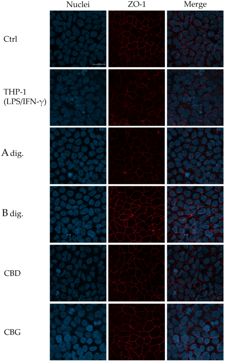 Effect of Cannabis extracts underwent to simulated digestion (A Dig., B Dig.) and cannabinoids (CBD, CBG) on the expression and organization of ZO-1, measured by immunofluorescence in enterocytes (differentiated CaCo-2). Cells were co-cultured with human macrophages (THP-1) stimulated with LPS/IFN-γ and treated with extracts (100 µg/mL) or pure molecules (8 µM) for 48 h. Representative images (60x magnification, 20 μm bar scale) report cell nuclei (DAPI, blue color) and membrane-associated ZO-1 (red color), in a separate and merged form