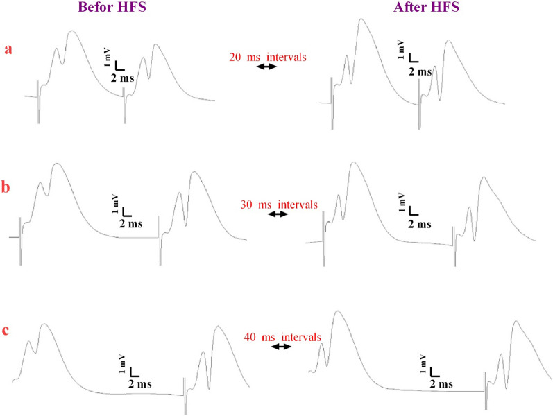 Representative sample traces of field potentials evoked by paired-pulse stimulation at intervals of 20 (a), 30 (b) and 40 (c) ms before and after high-frequency stimulation in the hippocampal PP-DG pathway in male rats