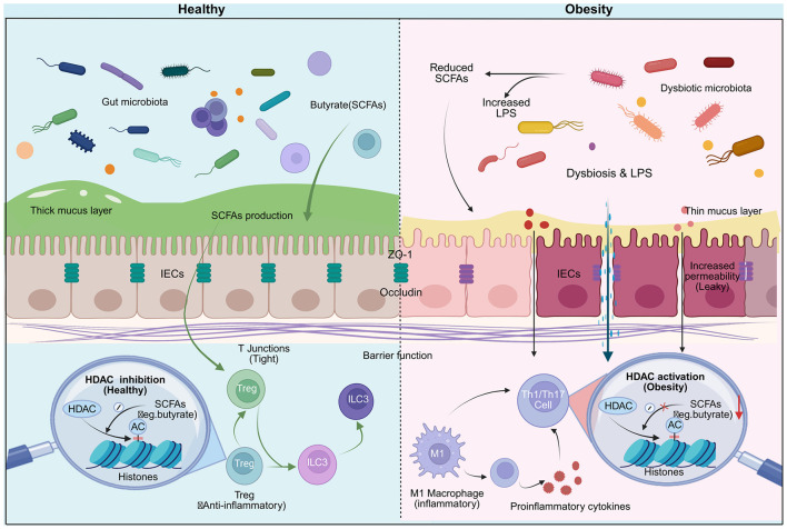 Diagram comparing healthy and obese gut environments. Healthy side shows diverse gut microbiota, thick mucus, strong barrier function, SCFA production, tight cell junctions, HDAC inhibition, and anti-inflammatory response. Obesity side features dysbiotic microbiota, thin mucus, increased permeability, reduced SCFAs, increased LPS, HDAC activation, and proinflammatory cytokine production.